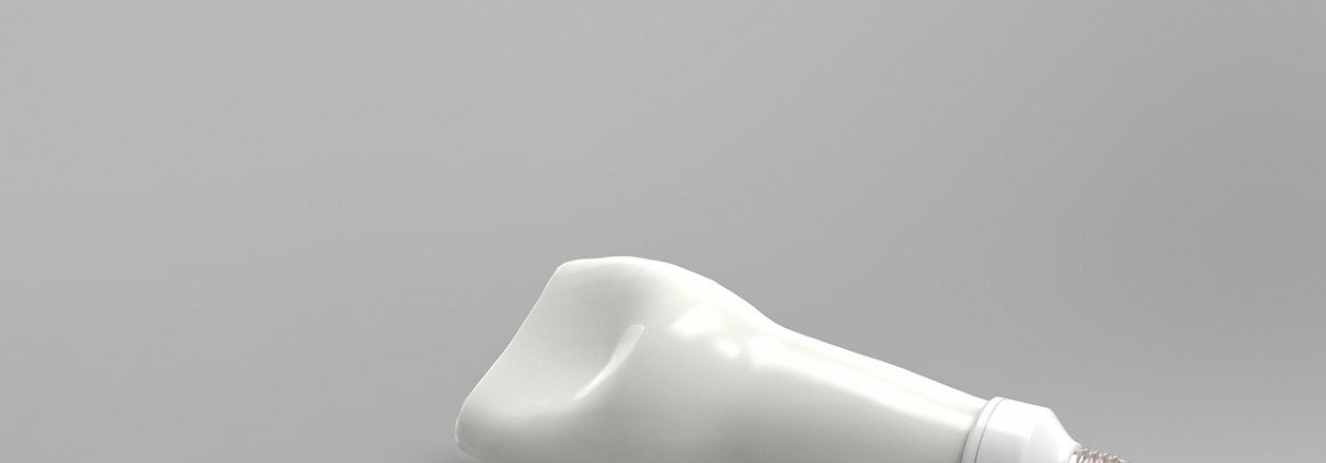 Was ist der Unterschied zwischen Sofortimplantat und Spätimplantat?